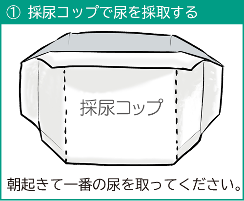 検体採取マニュアル 尿検査 株式会社町田予防衛生研究所