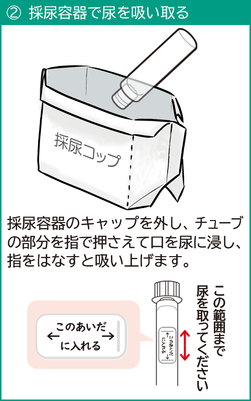 検体採取マニュアル 尿検査 株式会社町田予防衛生研究所